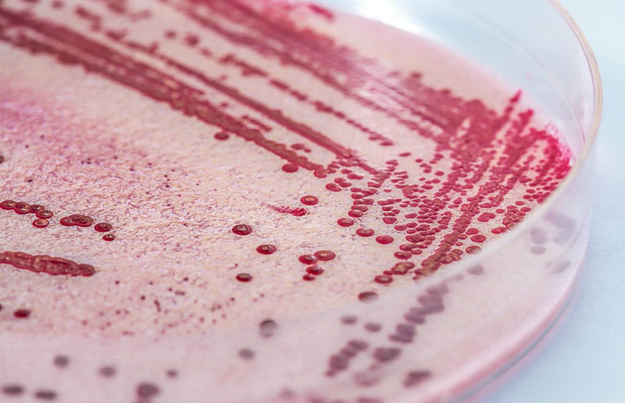Mérieux NutriSciences_Listeria Mérieux NutriSciences_Listeria